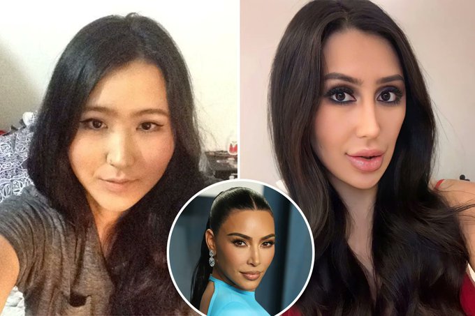 Woman Underways 15 Surgeries & Spend Rs. 49 Lakh to Look like Kim Kardashian