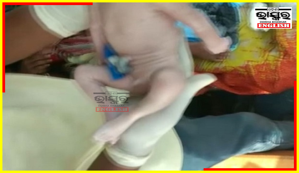 Baby Born Without Head & Mouth in Odisha's Mayurbhanj