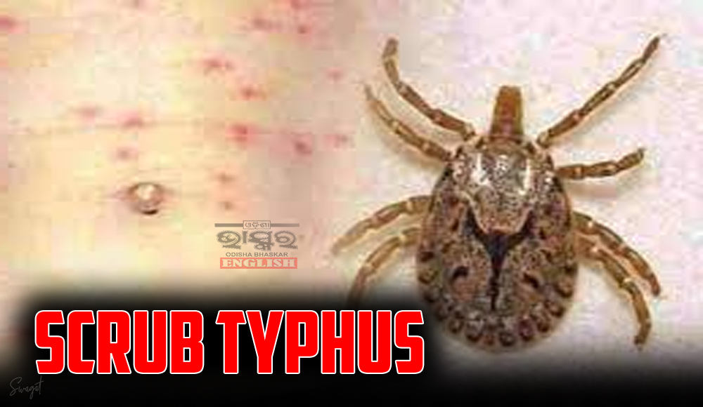 Late Diagnosis and Delayed Treatment Blamed for Scrub Typhus Deaths in Odisha